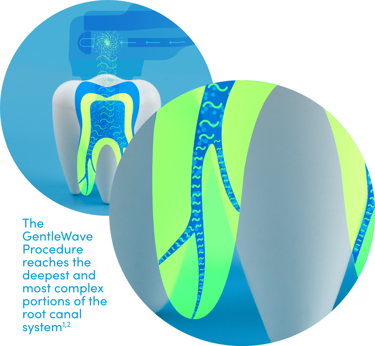 Choosing a Dentist or an Endodontist Root Canal Treatment